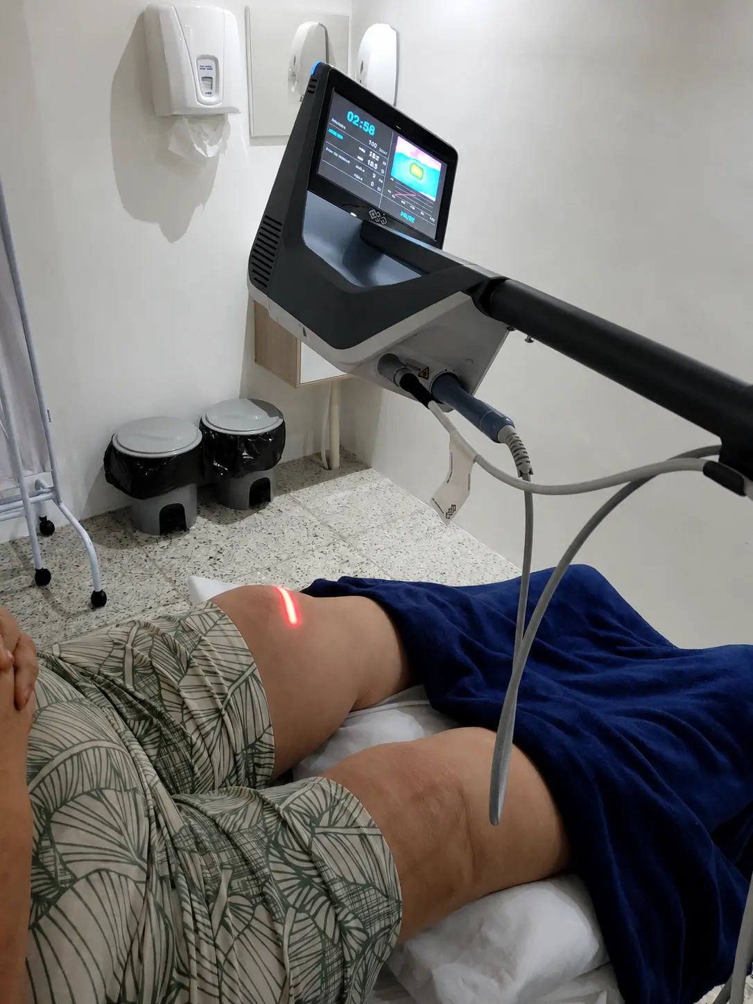 Sessão de laser de alta intensidade em Recife